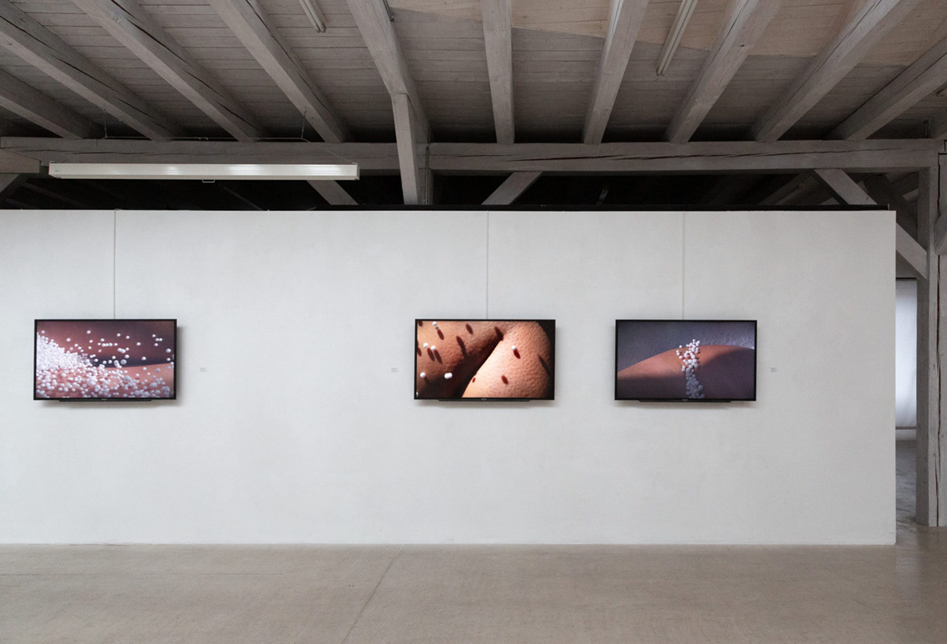 Sonja Lackner, Videos